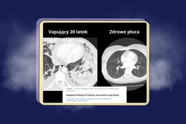 Tradycyjne papierosy kontra e-papierosy – czy można mówić o zdrowszej alternatywie?